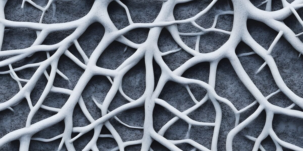 Root Cause